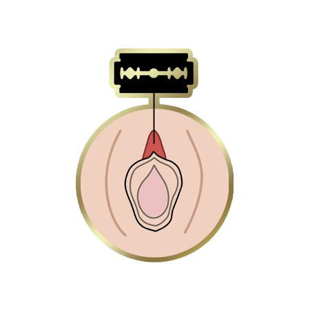 FGM Type-1