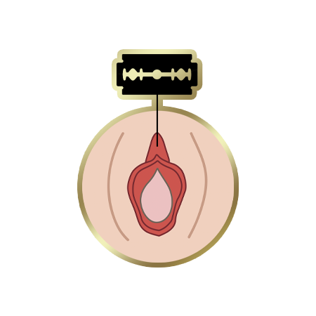 FGM Type-2