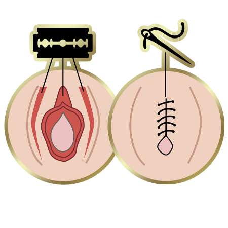 FGM Type-3